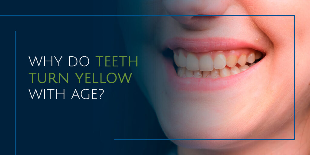 Why Do Teeth Turn Yellow With Age Drew Family Dentistry